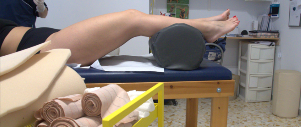 Bendaggio e calze compressive: guida completa per linfedema e lipedema